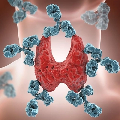 Natural treatment for autoimmune conditions using holistic methods and personalized care plans