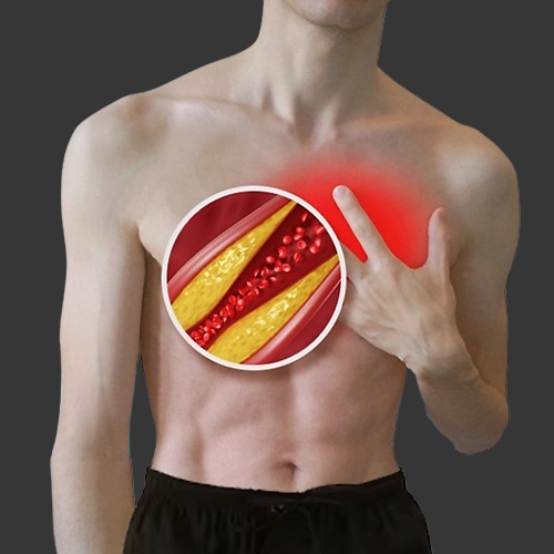 Cholesterol Management with Diet Counselling, Meerut